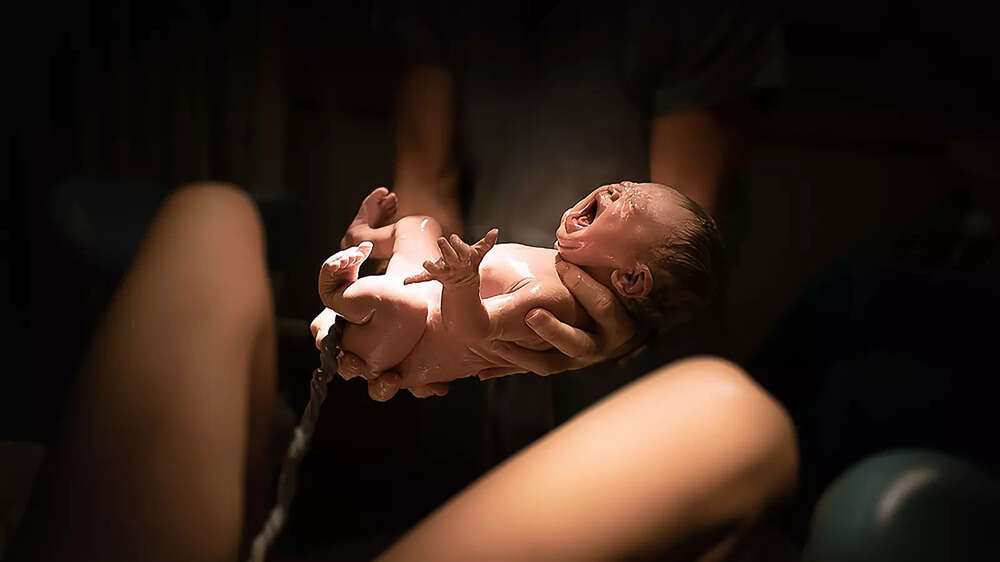 Lotus birth