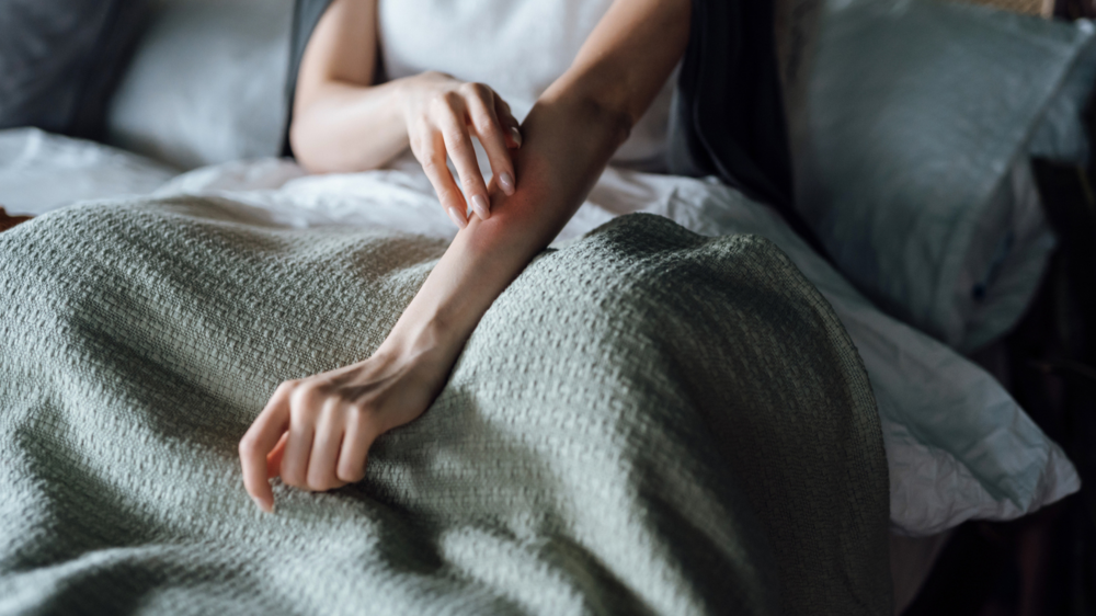 Pruritic Folliculitis of Pregnancy