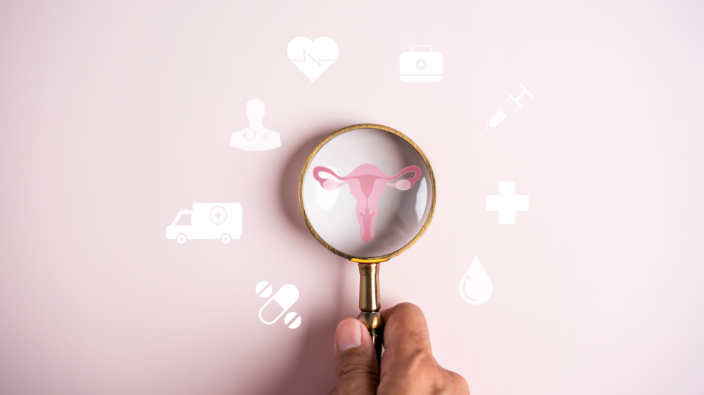 uterine fibroid