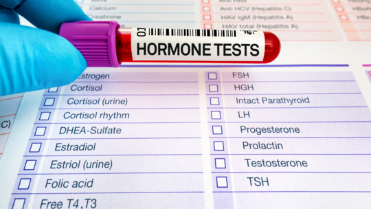 Prolactin Testing in Women Trying to Conceive: When and Why