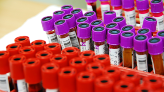 Do Blood Groups Matter When Trying to Conceive?