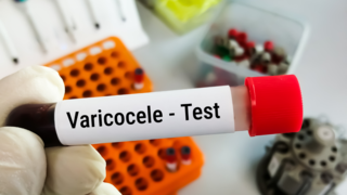 Understanding Varicocele and How It Affects Male Fertility