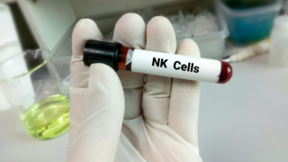 Natural Killer Cell Cytotoxicity in Infertile Women: What You Need to Know