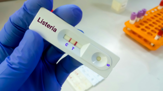 Listeria Infection in Pregnancy