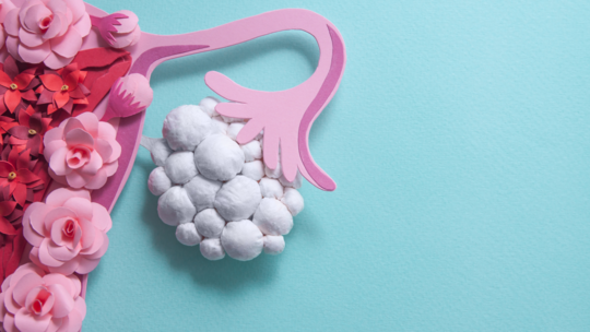 Trying To Conceive With PCOS: Realistic Tips That Actually Work