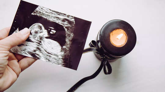 6 Tips to Prepare for Pregnancy After Miscarriage