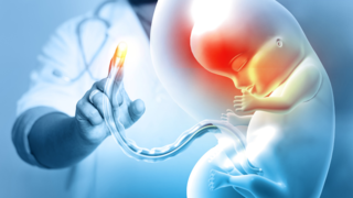 Managing Cord Position Issues During Pregnancy