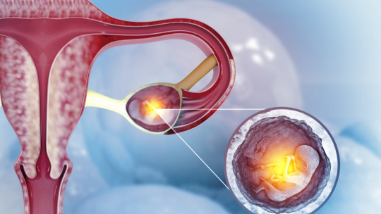 Misplaced Pregnancy After Infertility: Finding Strength to Try Again