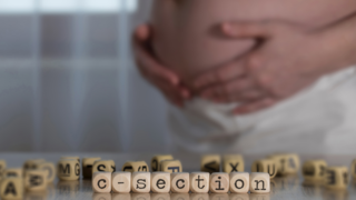 25 Things You May Not Know About a C-Section