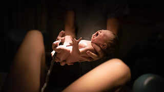 Understanding the Tradition, Practice, and Safety Concerns of Lotus Birth