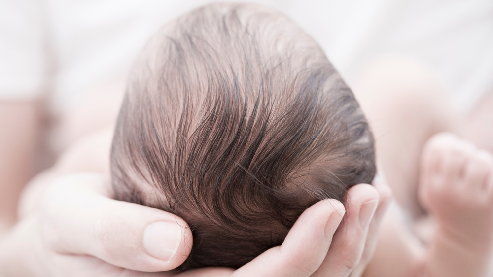 hydrocephalus