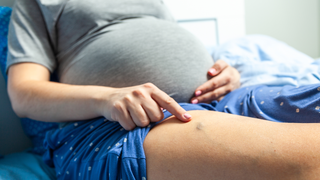 Swollen Vulvar Veins During Pregnancy: What You Need to Know
