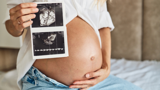 Why Doctors Monitor Twin Pregnancies More Closely