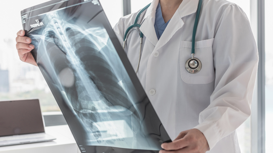 Tuberculosis in Pregnancy: Protecting Yourself and Your Baby