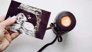 Preventing Stillbirth: Warning Signs, Monitoring and Evidence-Based Steps for a Safer Pregnancy