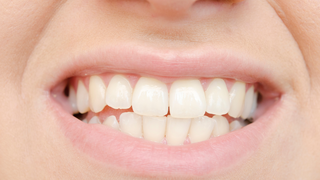 How Untreated Dental Problems Affect Pregnancy: Signs, Risks, and What You Should Do