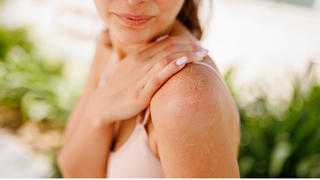 What are Postpartum Hives: Symptoms, Treatment, Recovery For Hives After Childbirth