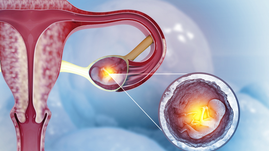 Understanding Ectopic Pregnancy: Signs and Symptoms of Ectopic Pregnancy