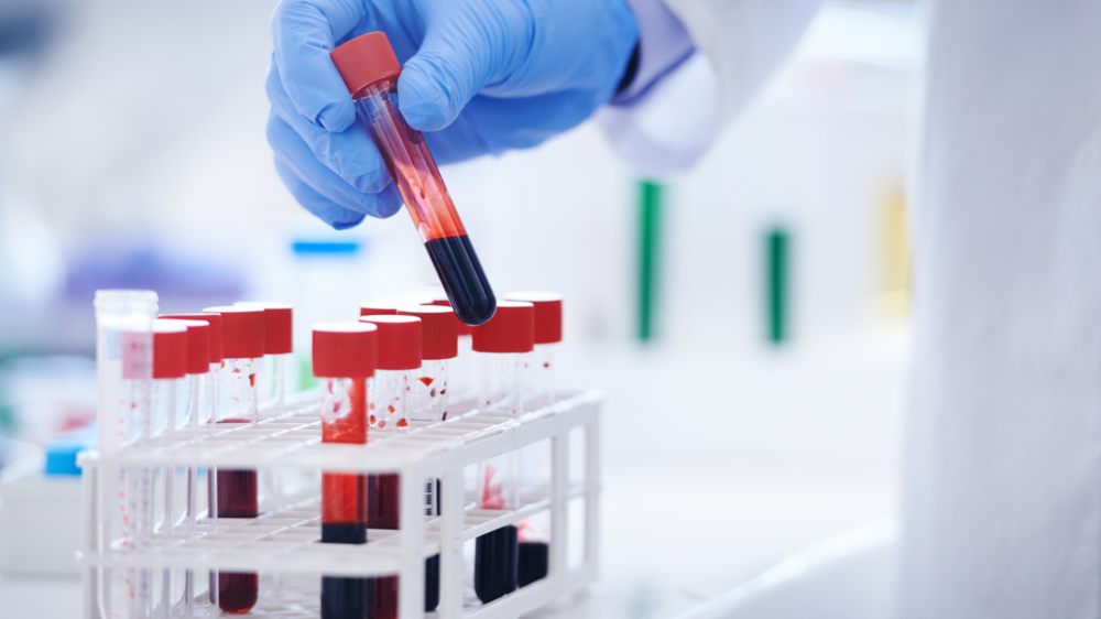What Blood Test Numbers Reveal in Very Early Pregnancy