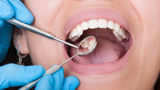 Medications for Dental Pain While TTC (What’s Safe?)