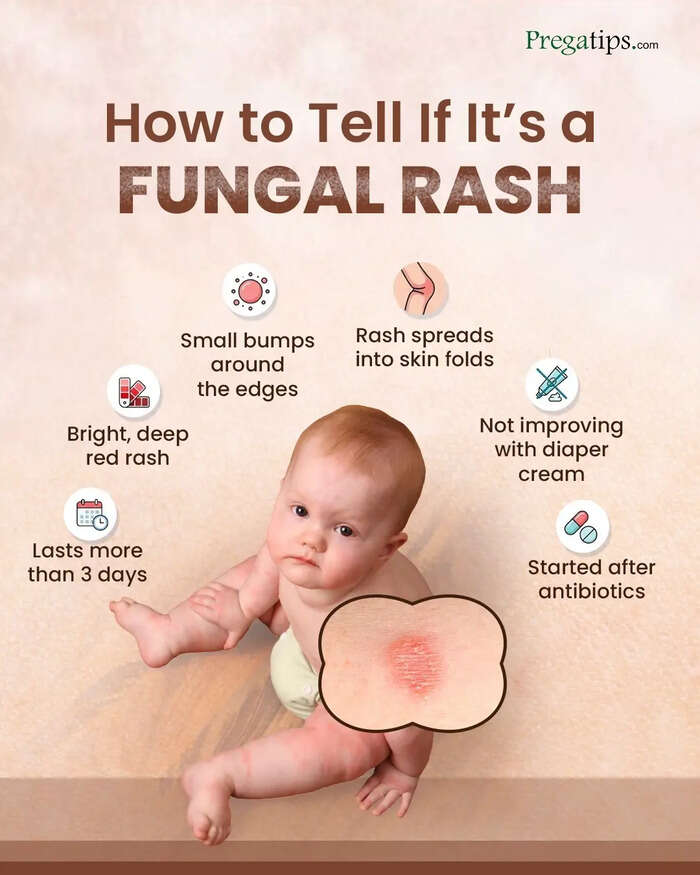 diaper rash