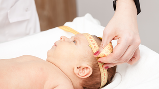 Flat Head Syndrome in Babies: What Helps and When Helmets Are Needed