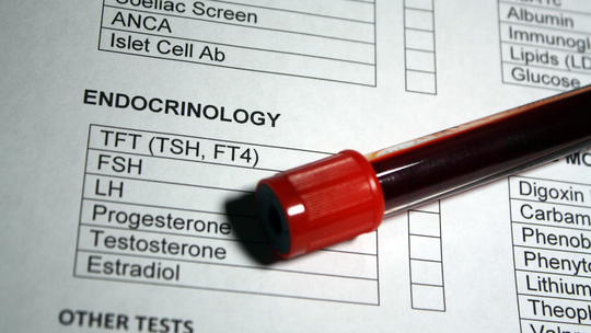 Pre-eclampsia and Hormones: What Oestrogen May Have to Do With It