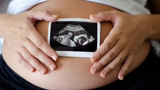 Can You Predict Labour Date from Baby's Position at 36 Weeks?