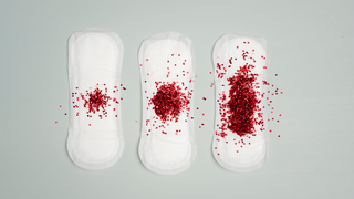 Implantation Bleeding vs Hormonal Spotting: How to Tell the Difference