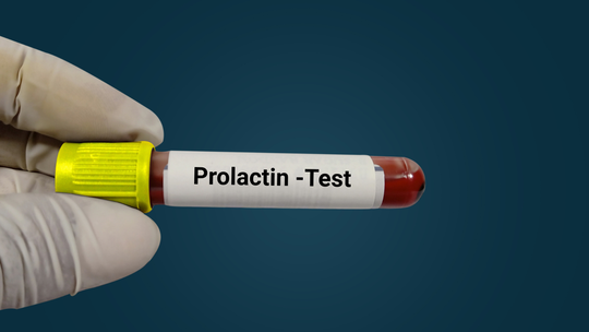 Why Treating High Prolactin Can Improve Pregnancy Outcomes