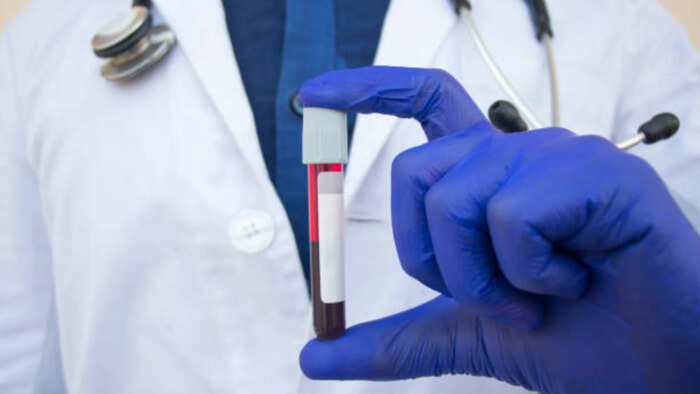 Blood donation during pregnancy: safe or not?