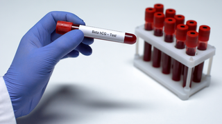 Slow-Rising hCG Levels: What They Mean and When to Seek Help