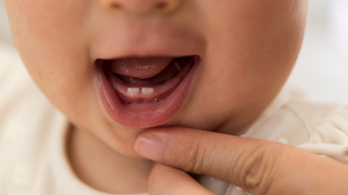 Babies Born With Teeth: Is It Normal and What Does It Mean?