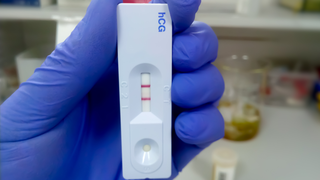 Why Does the hCG Hormone Rise in Week 4 of Pregnancy?