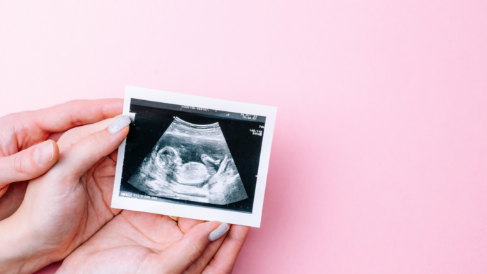 ultrasound
