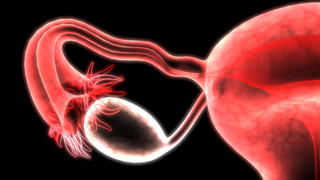 Can You Get Pregnant With One Ovary?