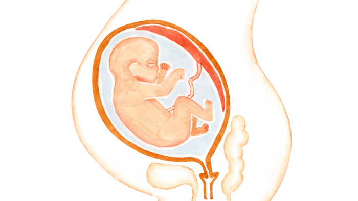 baby in breech2