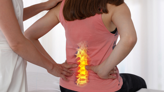 Is Back Pain After C-Section Permanent?