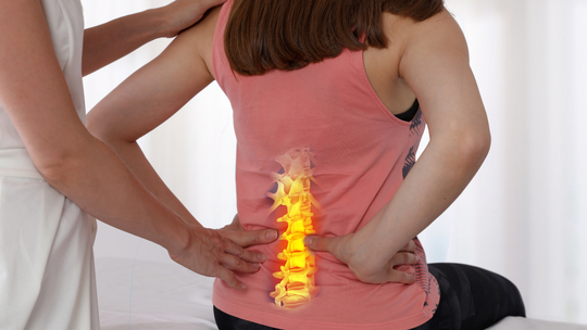 Is Back Pain After C-Section Permanent?