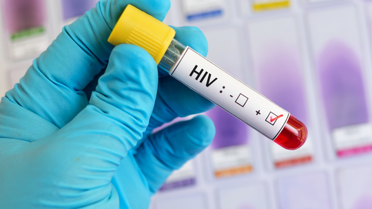HIV During Pregnancy: How It Can Affect You and Your Baby