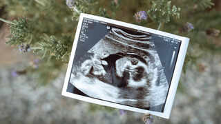 Foods to Support Healthy Foetal Growth and Weight Gain During Pregnancy