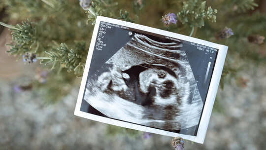 Foods to Support Healthy Foetal Growth and Weight Gain During Pregnancy