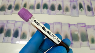 Why Mild Low Platelets Are Common in Late Pregnancy