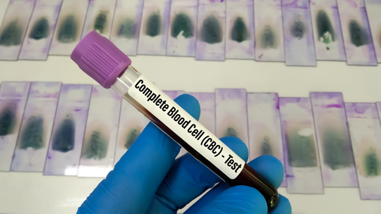 Why Mild Low Platelets Are Common in Late Pregnancy
