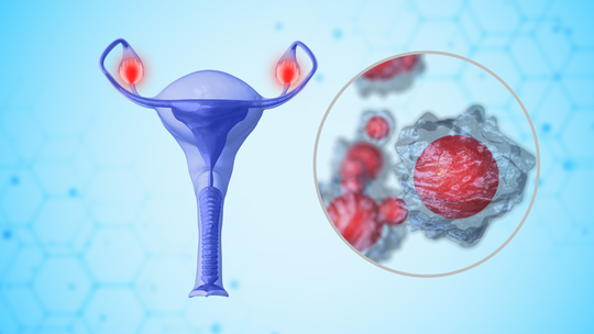 PCOS and Pregnancy: What Changes Once You Conceive
