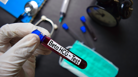 Beta-hCG Blood Test in Pregnancy: Normal Levels by Week