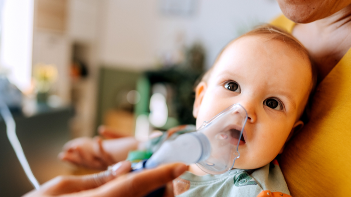 croup in babies2