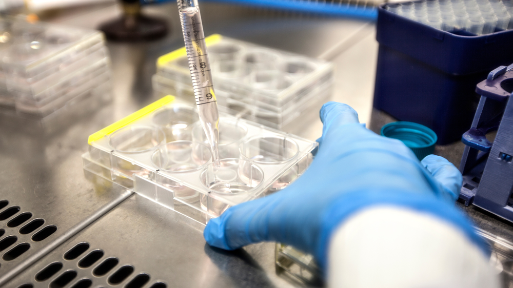What Is Follicular Fluid and Why Does It Matter in IVF?