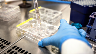 What Is Follicular Fluid and Why Does It Matter in IVF?