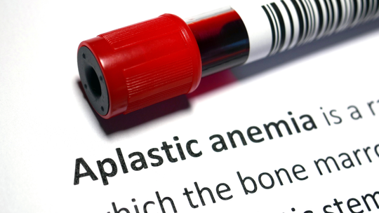 What Is Aplastic Anaemia in Pregnancy and How Can It Affect Mother and Baby?